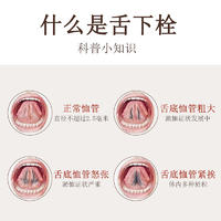 珂愈舌下溶栓喷剂1