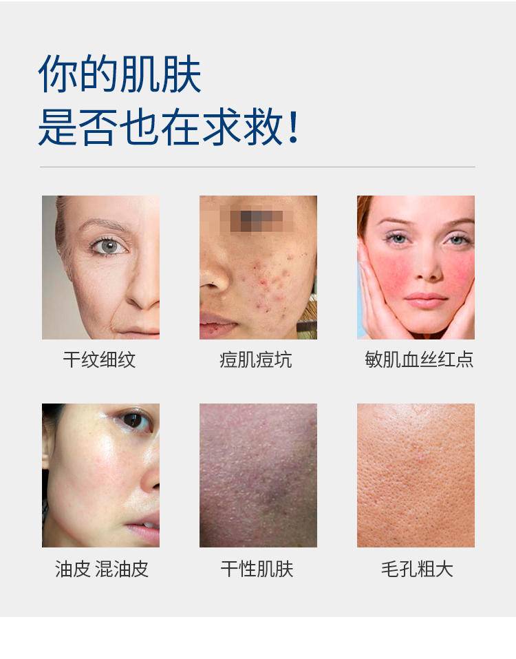 妍瑟水光多肽修护冻干粉淡化痘印多肽精华液41件套