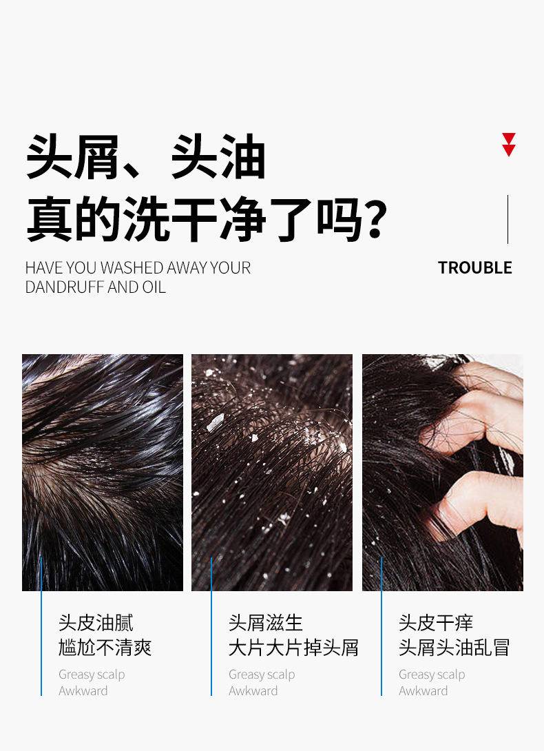 肌琳莎二硫化硒去屑洗发露 300ml