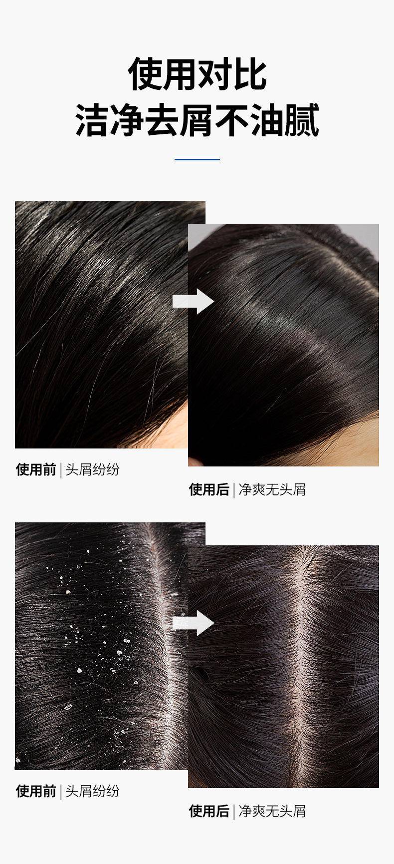 肌琳莎二硫化硒去屑洗发露 300ml