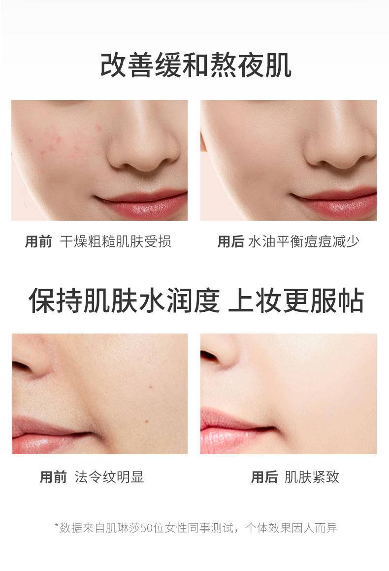 肌琳莎冻干粉黑绷带睡眠面膜