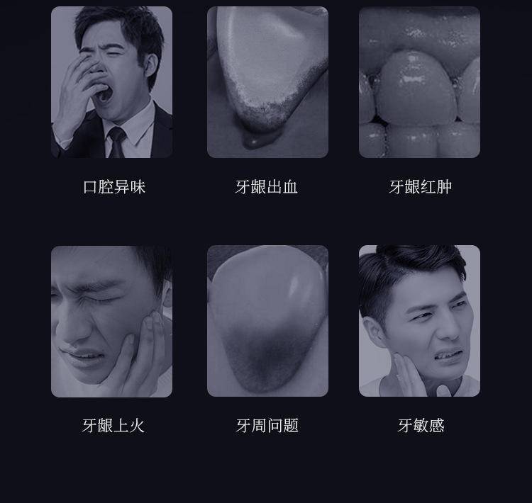 和风雨玻尿酸去渍护龈牙膏100g益生菌护龈牙膏2支装