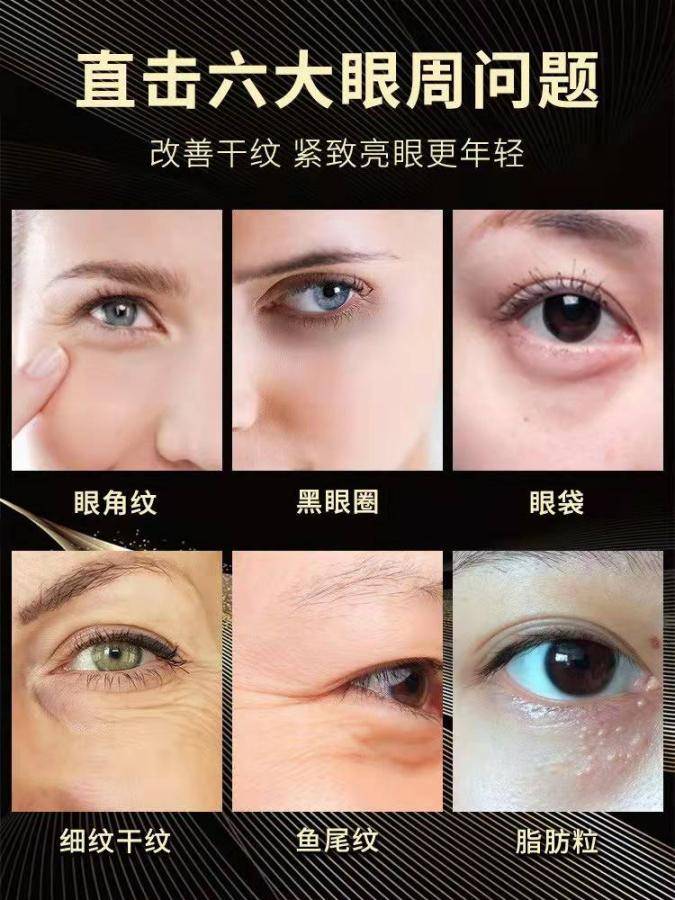 施逅黄金御龄蜂窝蝴蝶眼膜5片/盒