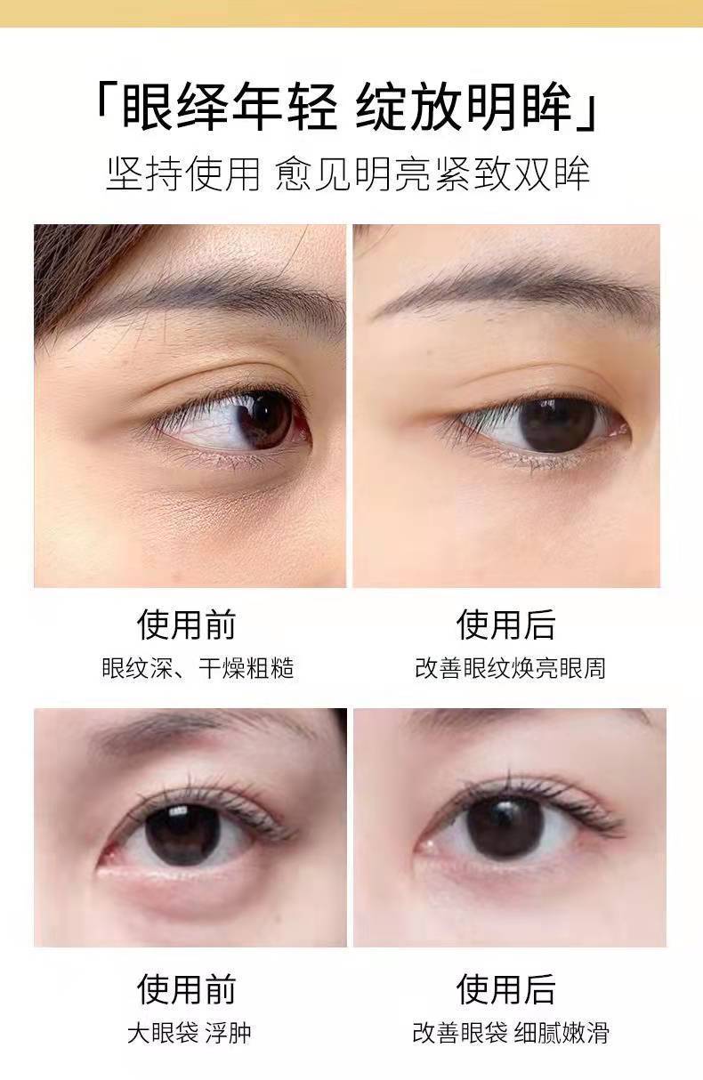 施逅黄金御龄蜂窝蝴蝶眼膜5片/盒