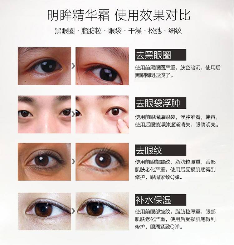 伊诗兰顿 弹力蛋白精华眼霜16g/瓶