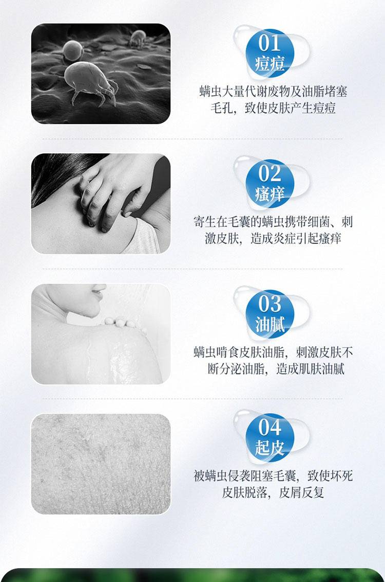 征服清爽止痒沐浴露335ml A2859