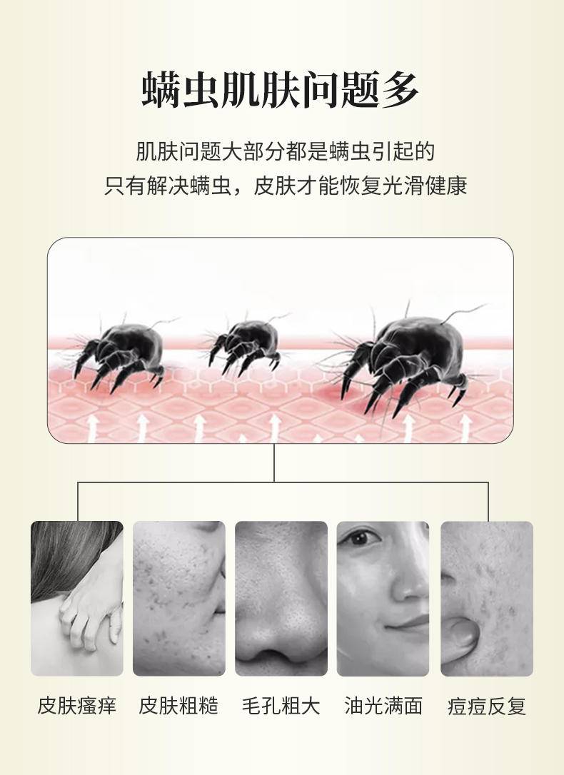 舒缇108g天然硫磺护肤皂