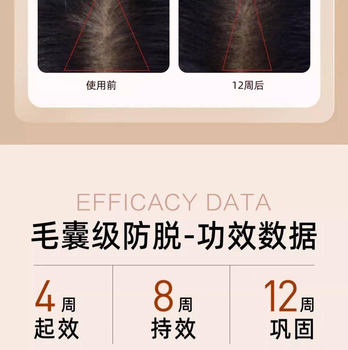 【国家药监局认证防脱】海瑟薇防脱固发生姜洗发水强韧去屑洗发膏