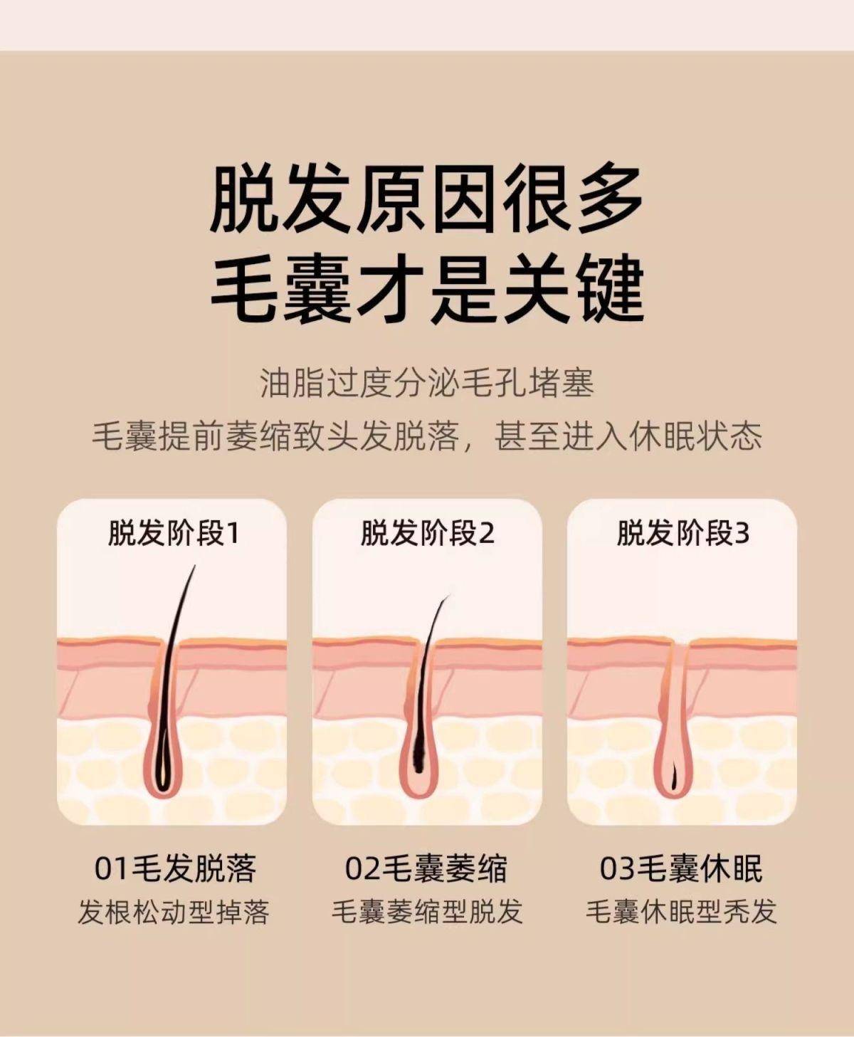 【国家药监局认证防脱】海瑟薇防脱固发生姜洗发水强韧去屑洗发膏