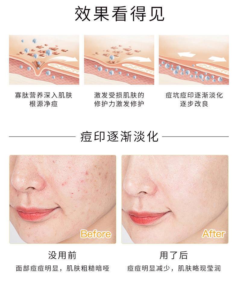极颜美亚紧致补水寡肽固态冻干片1
