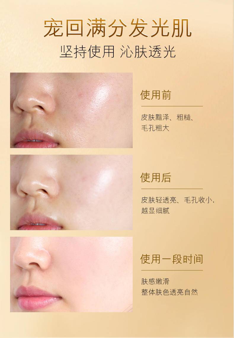 韩美素M1烟酰胺维C焕肤套盒