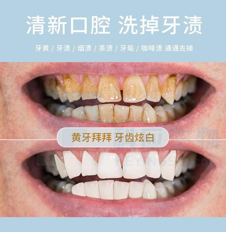 拍一发二HEAIQI琦憶-益生菌珍珠净白洁牙粉