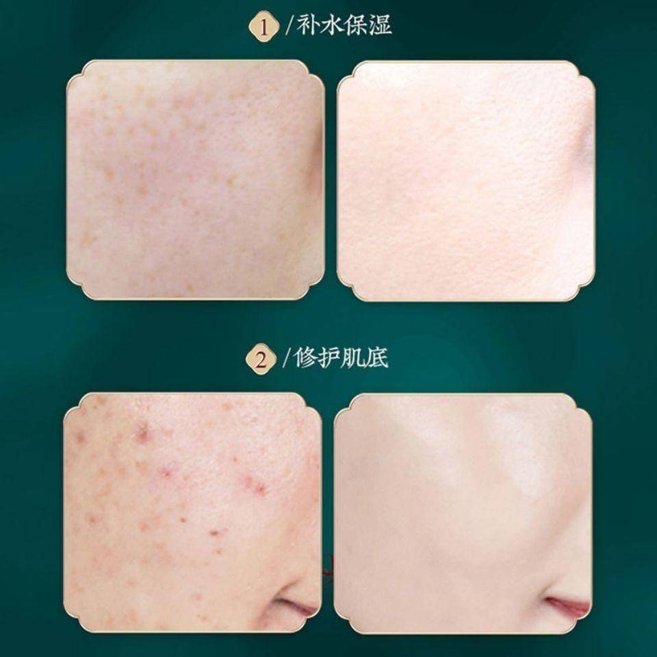 巧莹壳聚糖多肽嫩肌七件套2