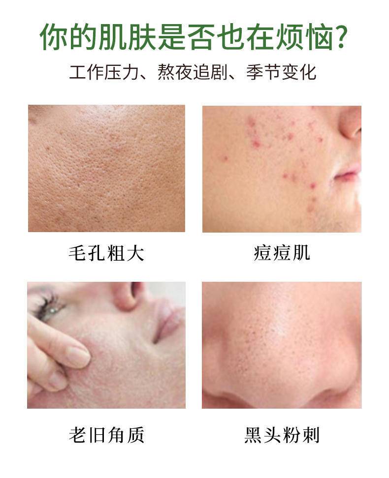 琦憶海绵海藻针70%高含量海藻针套盒净颜焕肤微晶组合收缩毛孔祛痘1