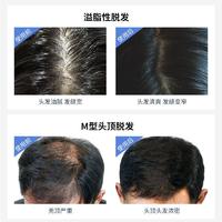 药都仁和优挺育发液