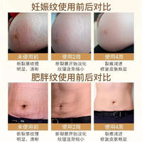  仁和匠心 抚纹多效修护精华霜