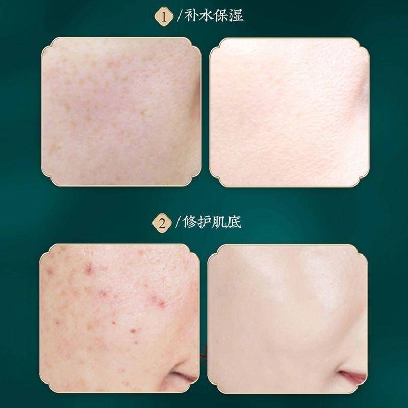 巧莹壳聚糖多肽嫩肌七件套2