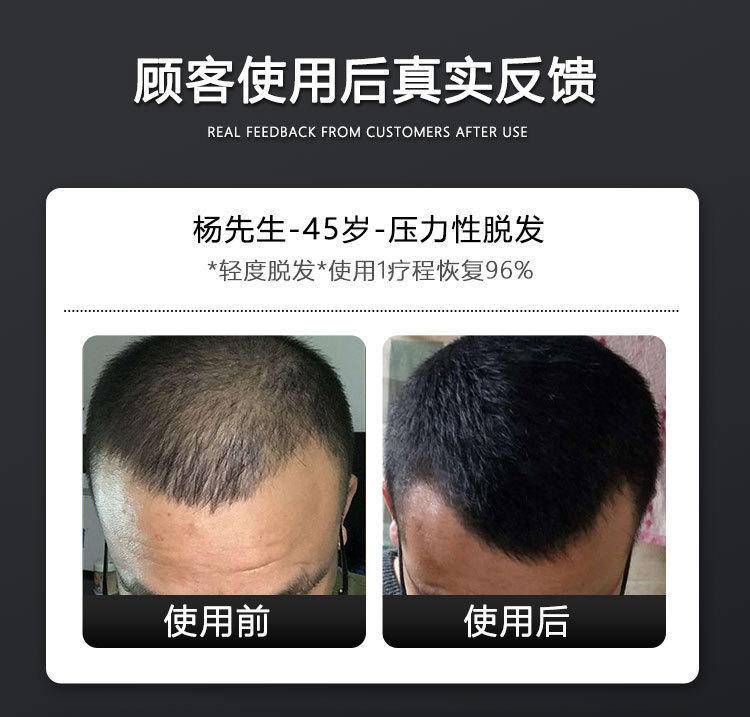 仁和匠心生姜防脱发洗发水液