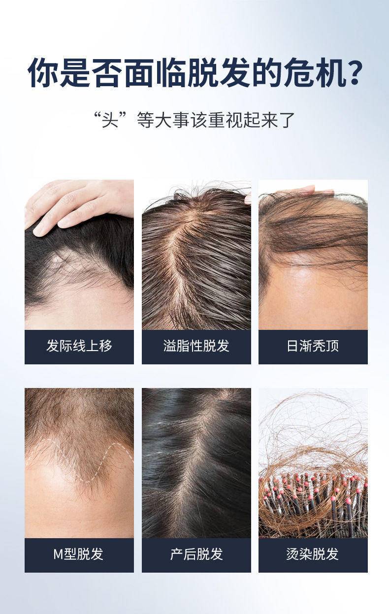 药都仁和优挺育发液
