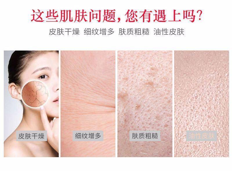 护肤5件套