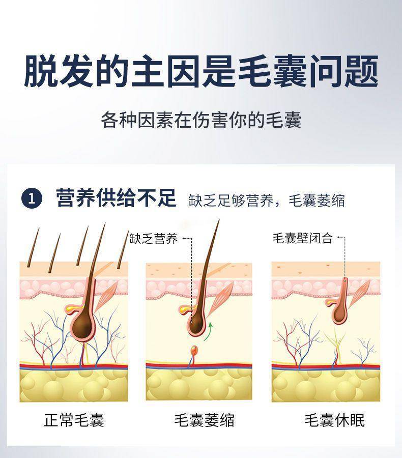 药都仁和优挺育发液