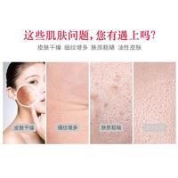 护肤5件套