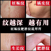  仁和匠心 抚纹多效修护精华霜