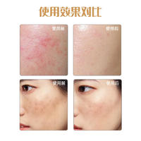 极颜美亚敏感肌贻贝粘蛋白喷雾1